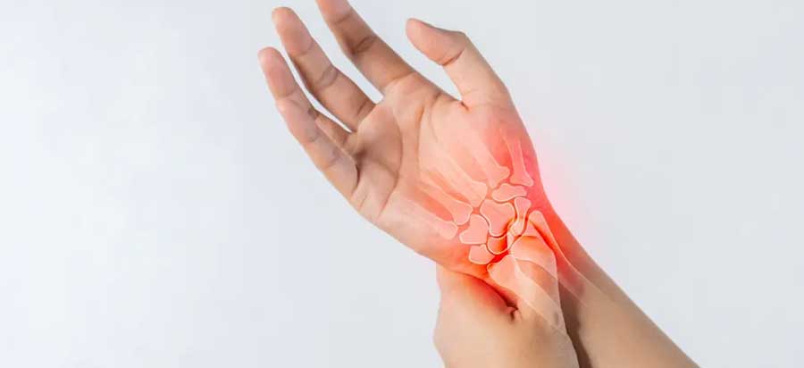 Carpal Tunnel Syndrome