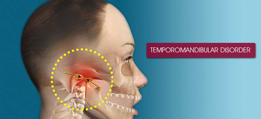 TMJ Joint Dysfunction Physiotherapy